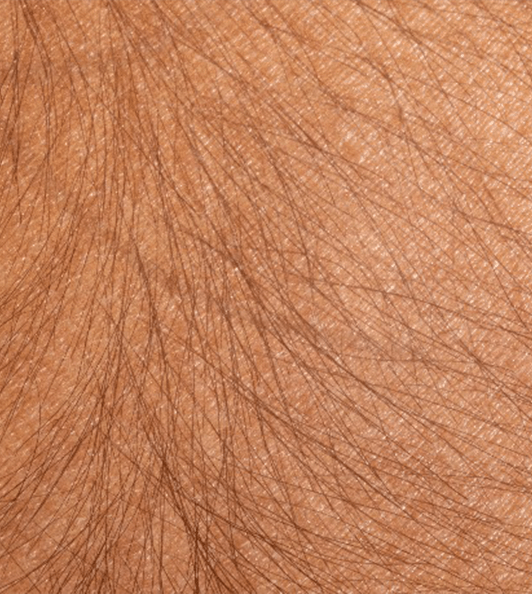 pelos 01