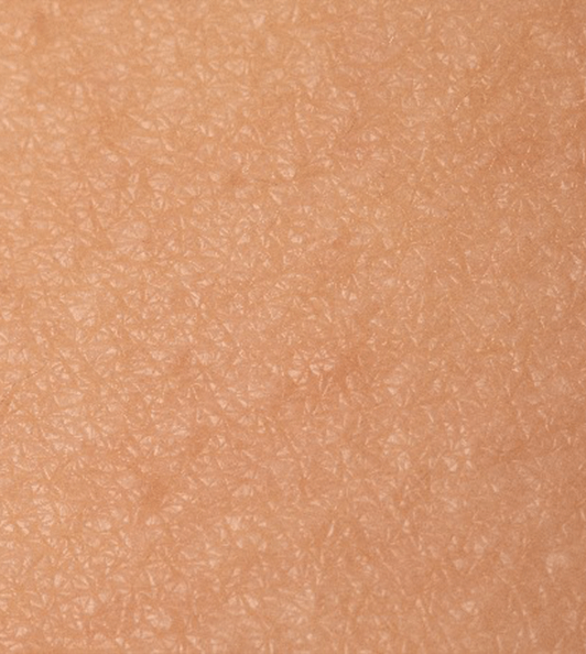 pelos 02